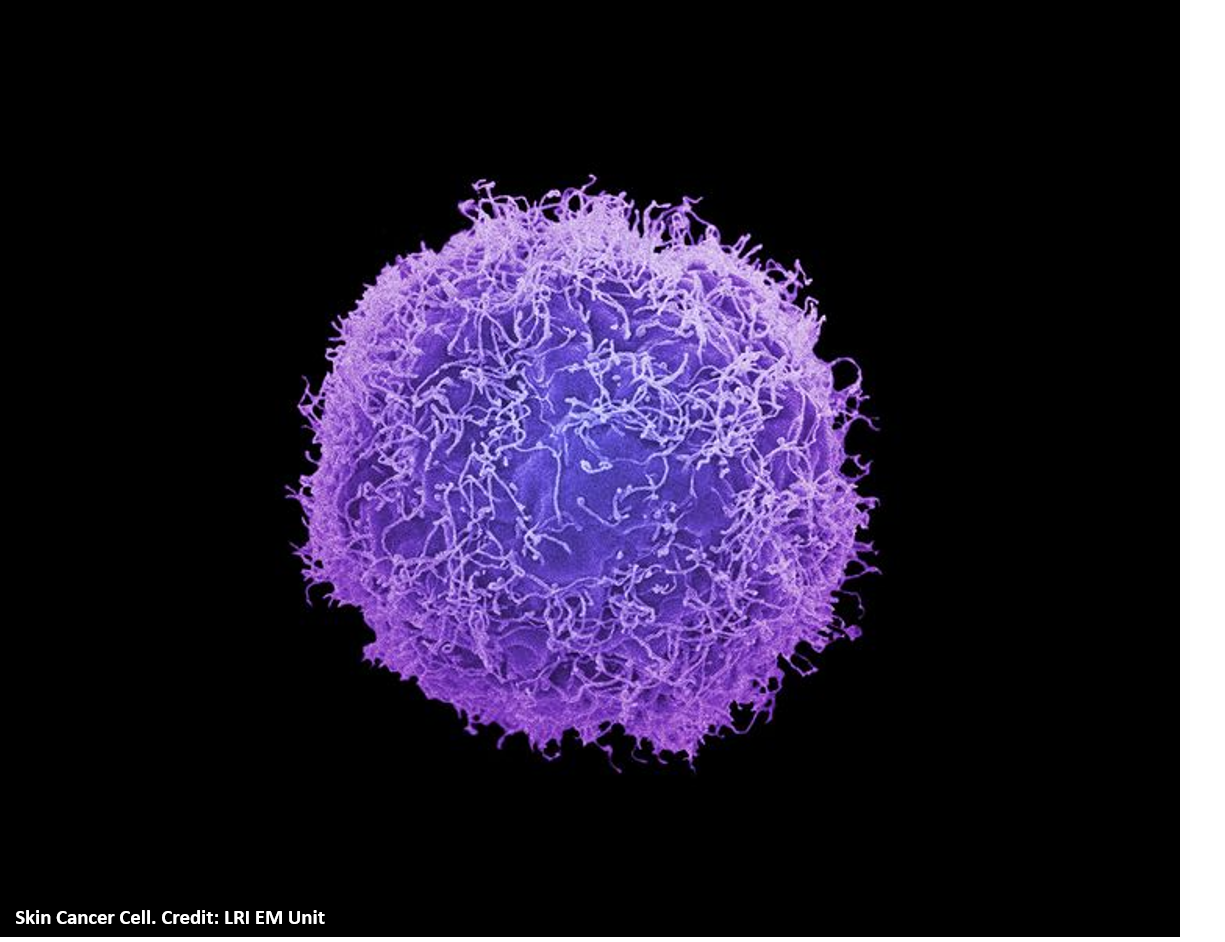 Skin Cancer Cell 2