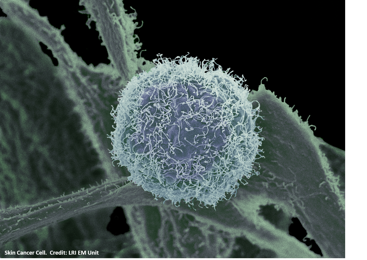 Skin Cancer Cell Line
